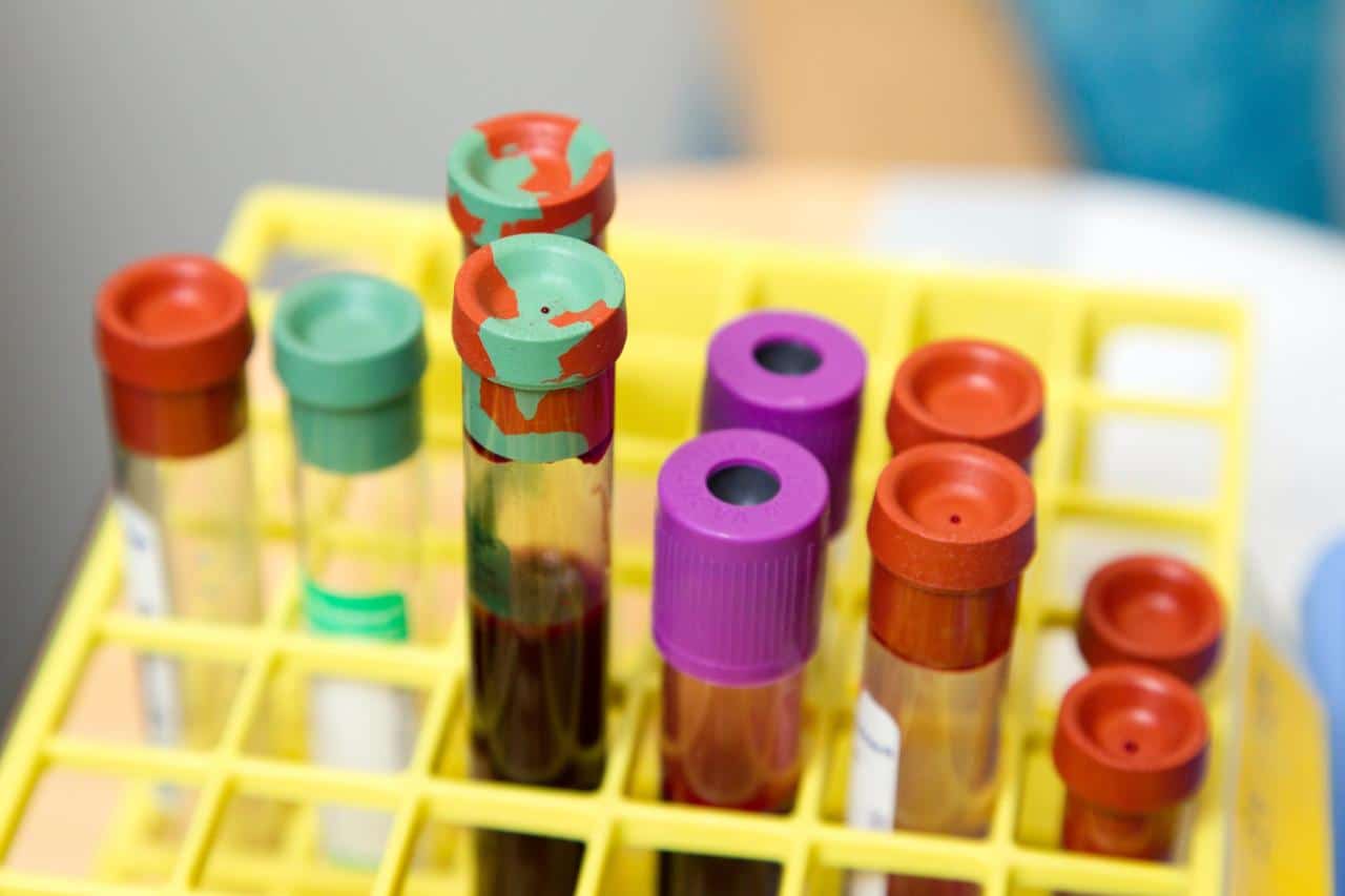 How long does marijuana stay in your system for a urine test