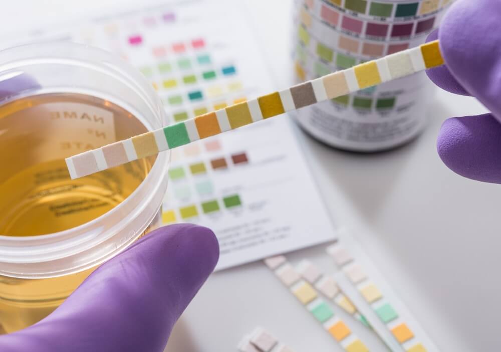 How long does THC stay in your system for a urine test